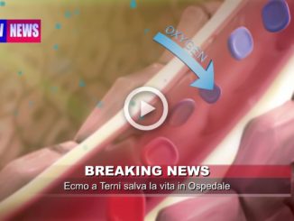 Morbo del legionario a Terni donna con Legionella viva grazie a Ecmo il video