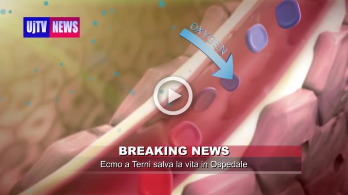 Morbo del legionario a Terni donna con Legionella viva grazie a Ecmo il video