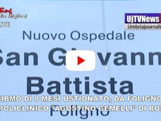 Bimbo di 8 mesi ustionato dall'acqua che serviva per il biberon, è al Gemelli di Roma