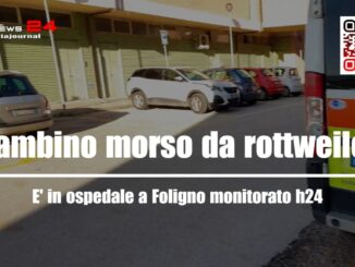 Bimbo aggredito da un rottweiler, in ospedale monitorato h24
